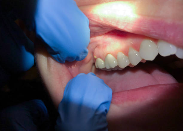 Best Emergency Dental Services for Seniors in Ware Shoals, SC