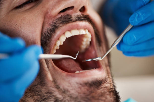 Best Emergency Dentist for Knocked-Out Tooth in Ware Shoals, SC